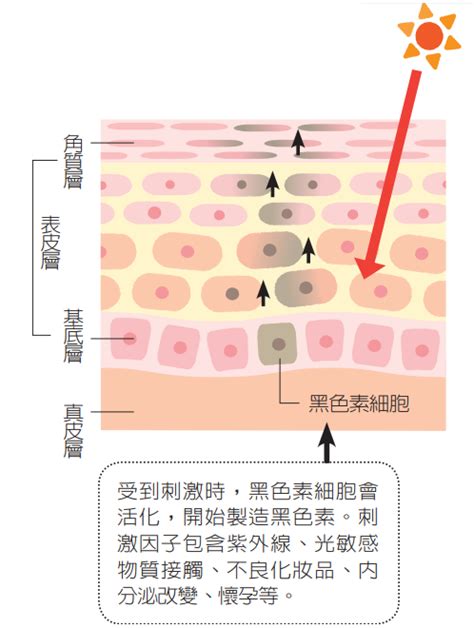 臉頰的斑|一次解析曬斑、肝斑、雀斑、顴骨母斑等皮膚黑斑原因…